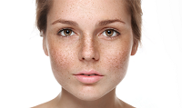 Pigmentation: Know the causes and the cure